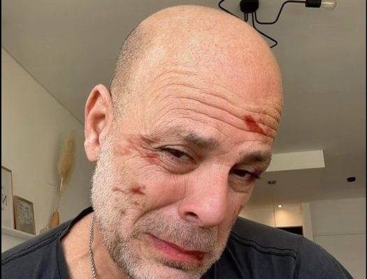 Bruce Willis’ wife Emma Heming shares heartbreaking video of him after his dementia diagnosis